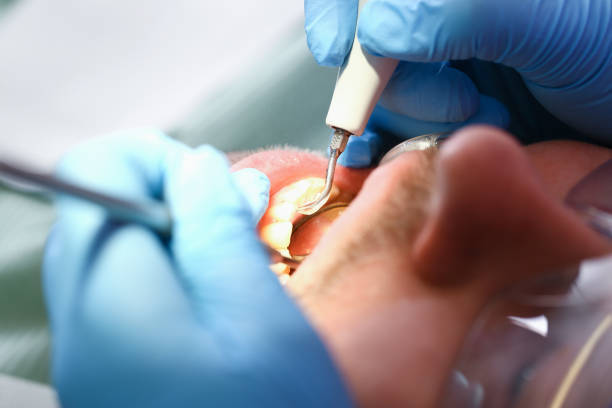Best Weekend Emergency Dental Services in Dewitt, IA