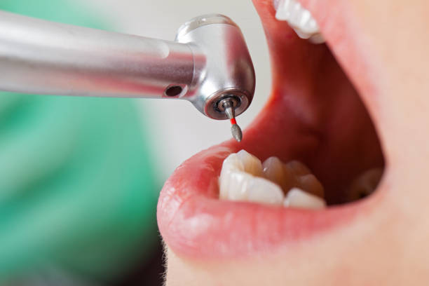 Best Emergency Root Canal Therapy in Dewitt, IA